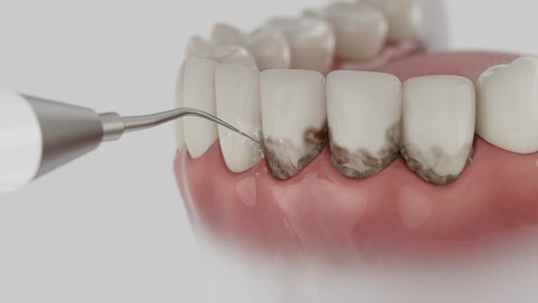 Trusted Tooth Extraction service in North Pekin, IL - Dentist Open Now